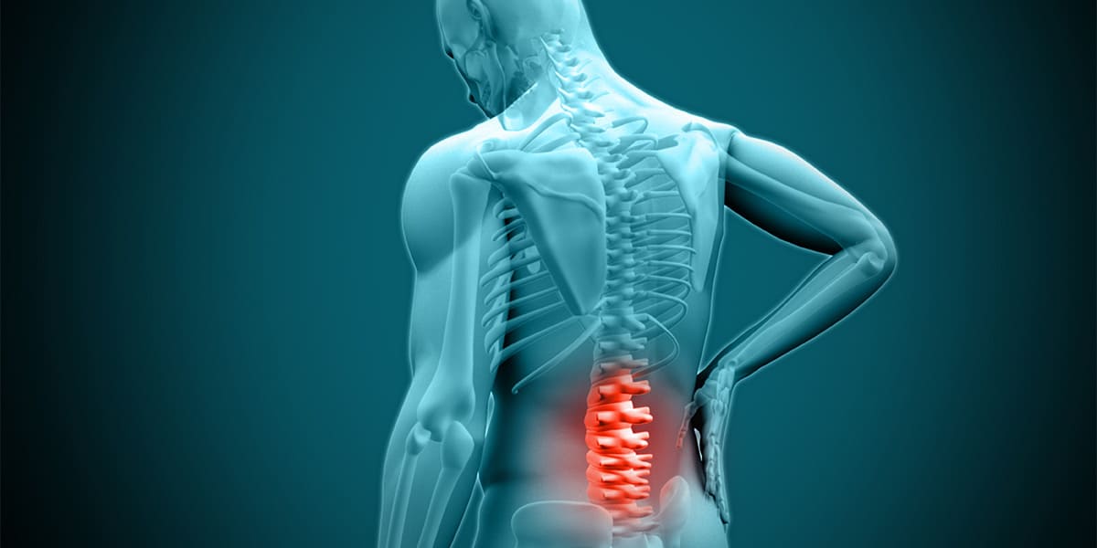 Lumbar Herniated Disc: Causes, Symptoms & Treatment Lumbar Herniated Disc: Causes, Symptoms & Treatment