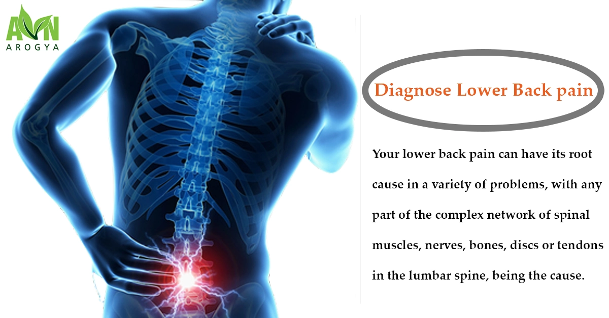 The Causes of Lower Back Pain